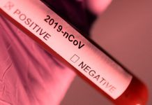 Odisha registered 3,922 fresh COVID Positive Cases. With this, total cases in Odisha increased to 2,09,374.